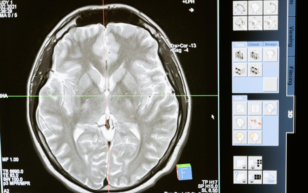 Boost Your Brain: Habits to Support Cognitive Health